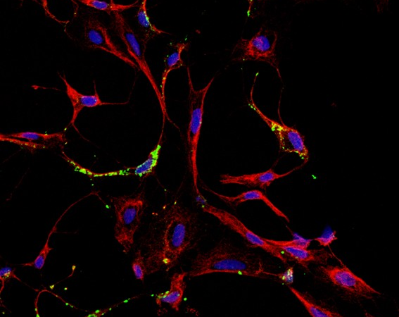 Mayaro e o que mais? Unicamp aponta possível transmissão urbana do vírus em Roraima e vê indícios de novas ameaças
