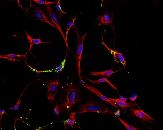 Mayaro e o que mais? Unicamp aponta possível transmissão urbana do vírus em Roraima e vê indícios de novas ameaças