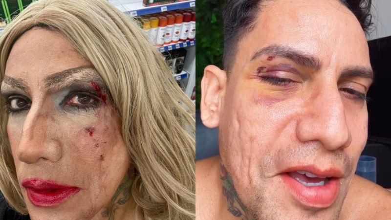 Arquiteto é agredido com soco e xingado no carnaval de Olinda e denuncia homofobia