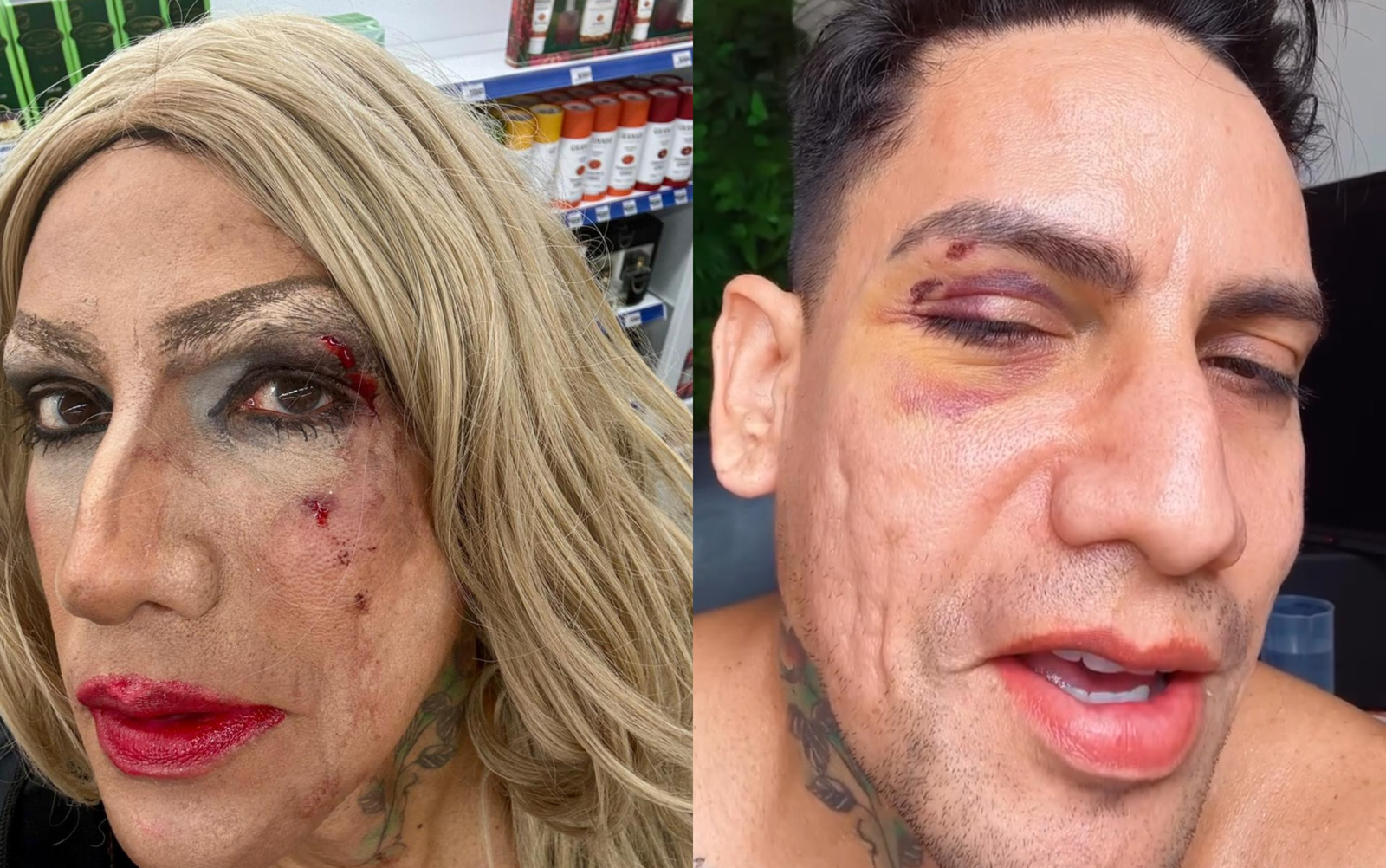 Arquiteto é agredido com soco e xingado no carnaval de Olinda e denuncia homofobia
