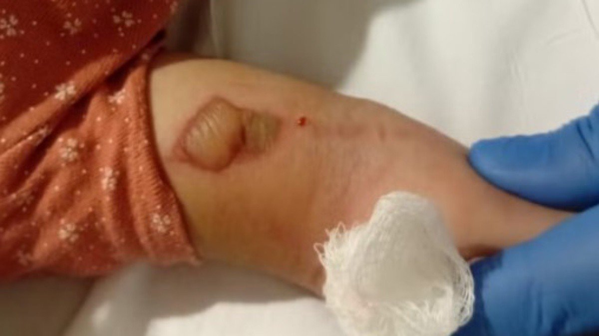 Polícia investiga morte de bebê em hospital de Niterói, e família diz que medicação foi trocada: ‘Nome da outra criança’