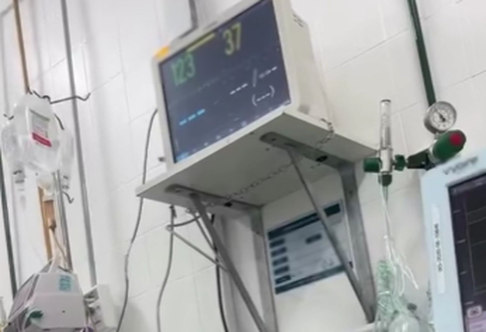 Mãe denuncia queda de aparelho médico sobre cabeça de bebê de 8 meses em hospital de Aracaju