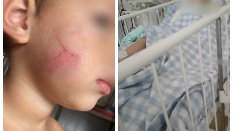 Bebê é internado com hemorragia e traumatismo craniano; irmão de 3 anos relata agressão de babá