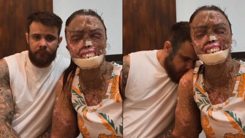 ‘De 4 em 4 horas’: influencer cearense com câncer em fase terminal tem rotina de dores e morfina