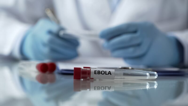 Suspeita de Ebola é descartada em pacientes no Rio e em SP: o que se sabe