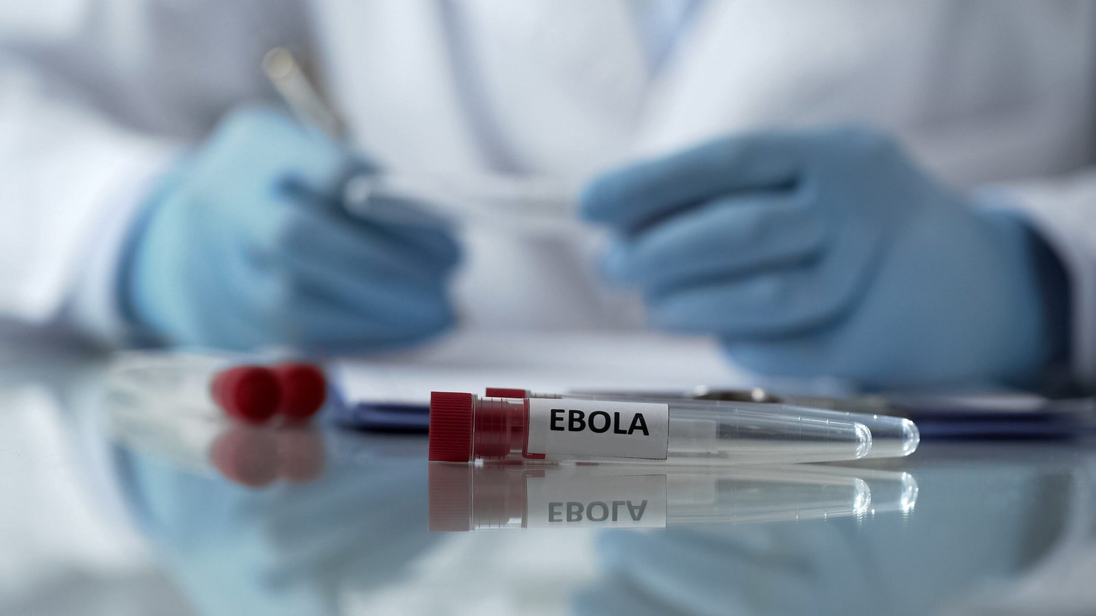 Suspeita de Ebola é descartada em pacientes no Rio e em SP: o que se sabe