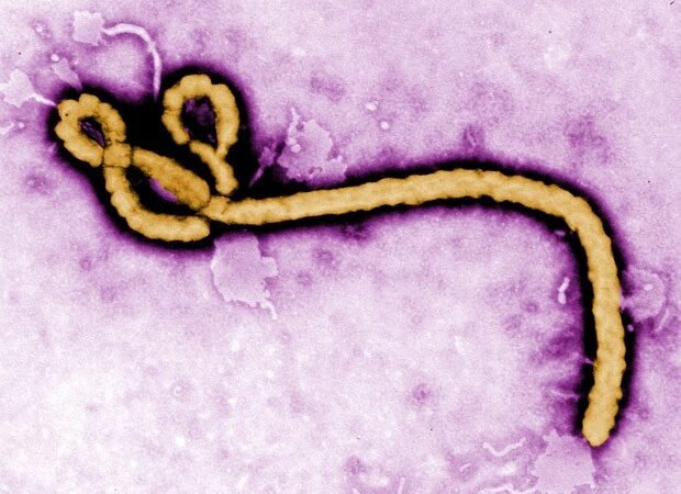 França registra 1° caso de ebola; paciente é um médico que atuava na República Democrática do Congo