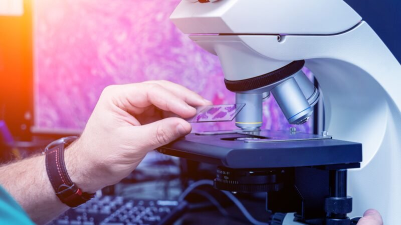 Por que mais jovens estão tendo câncer? Estudo aponta envelhecimento acelerado do organismo como possível explicação