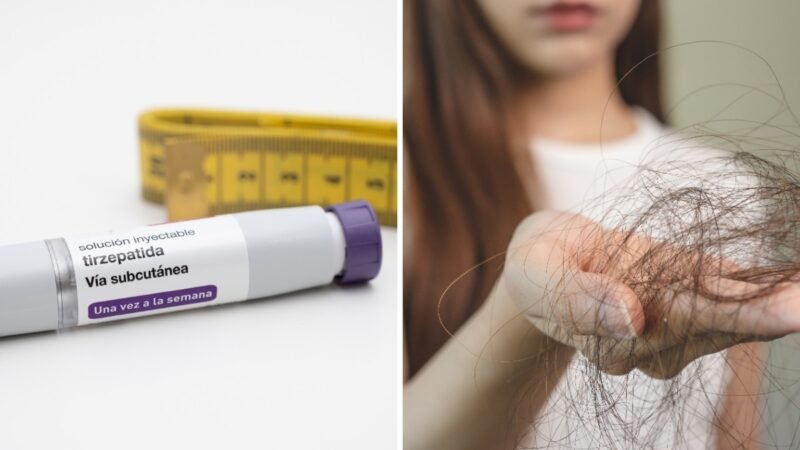 Queda de cabelo com canetas emagrecedoras: por que ocorre e como prevenir