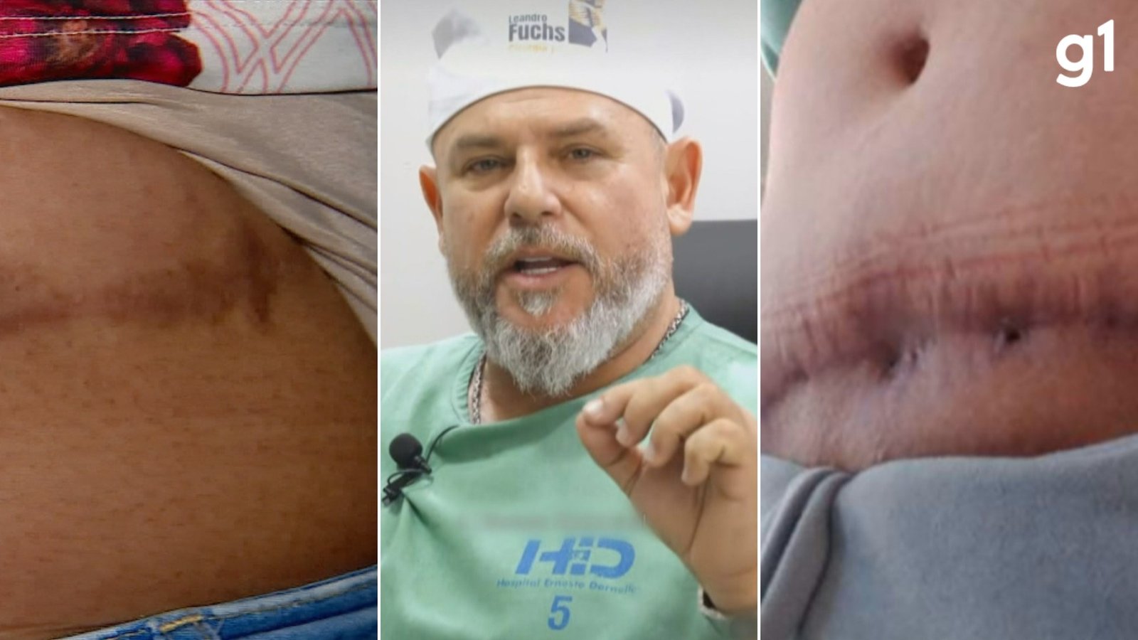 ‘Me sinto como se fosse um lixo’, diz paciente de cirurgião plástico réu acusado de quatro tipos de crime ao operar mulheres