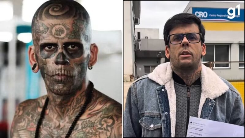 Cirurgia do ‘homem mais tatuado do Brasil’ será decisiva para definir gravidade de tumor na bexiga