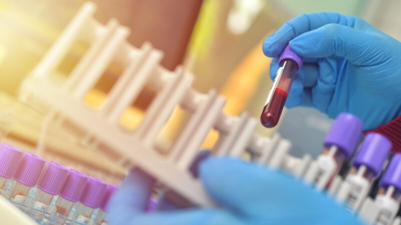 Pesquisa com mais de 28 mil pessoas descobre ‘freio’ que pode ser chave para novos tratamentos de doenças hereditárias do sangue