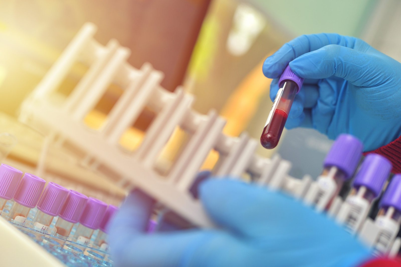 Pesquisa com mais de 28 mil pessoas descobre ‘freio’ que pode ser chave para novos tratamentos de doenças hereditárias do sangue