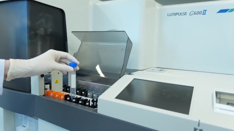 Exame de sangue para Alzheimer chega ao Brasil: veja quem pode fazer, quanto custa e o que o resultado revela